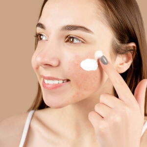 Tono de piel e imperfecciones